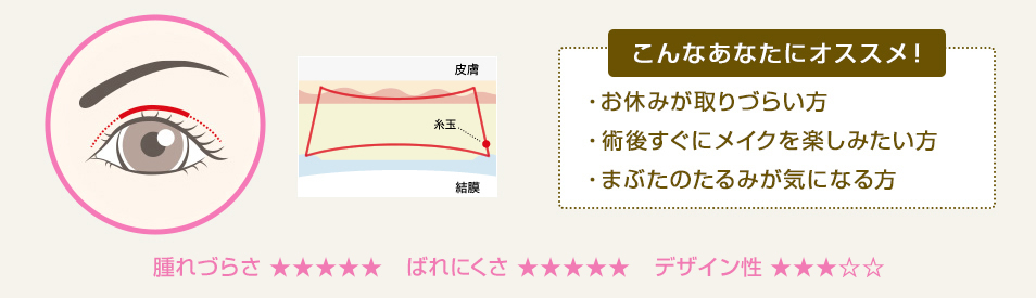 こんなあなたにオススメ！ ・キリッと目力のある二重になりたい ・アイプチを手放せない方 ・まぶたのたるみが気になる方