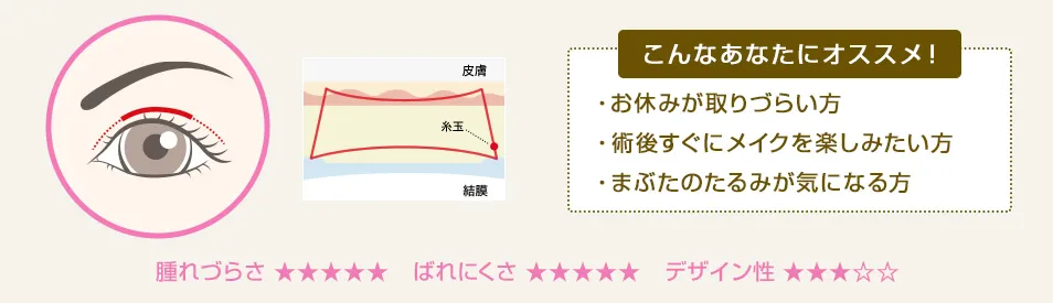 こんなあなたにオススメ！ ・キリッと目力のある二重になりたい ・アイプチを手放せない方 ・まぶたのたるみが気になる方