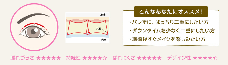 ・バレずに、ぱっちり二重にしたい方 ・ダウンタイムを少なく二重にしたい方 ・施術後すぐメイクを楽しみたい方