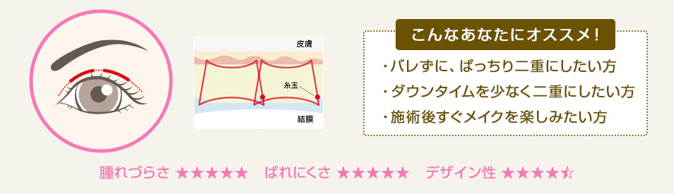 ・バレずに、ぱっちり二重にしたい方 ・ダウンタイムを少なく二重にしたい方 ・施術後すぐメイクを楽しみたい方