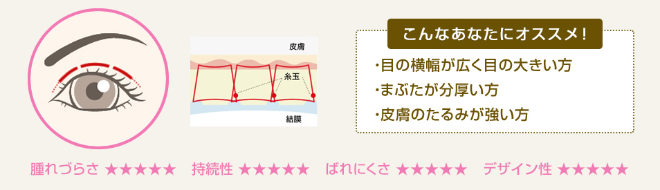 ・目の横幅が広く目の大きい方・まぶたが分厚い方・皮膚のたるみが強い方