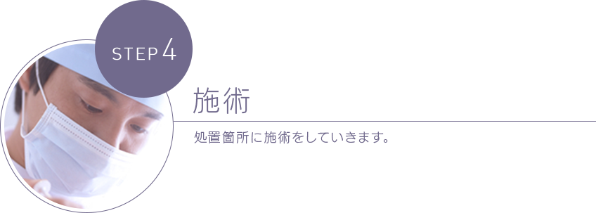 施術 処置箇所に施術をしていきます。