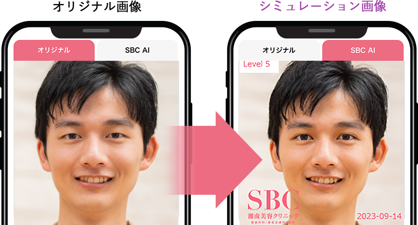 症例5