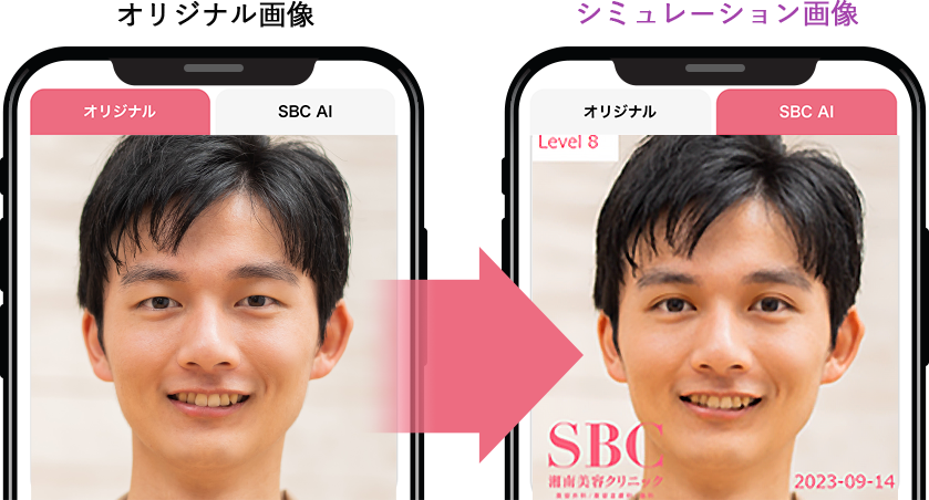 症例8