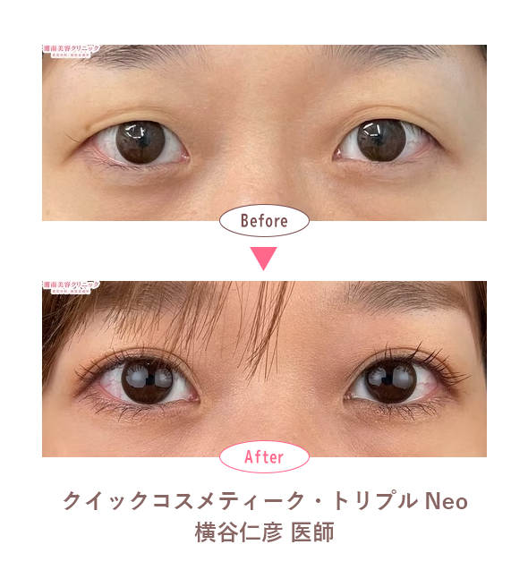 症例写真（No.305645）