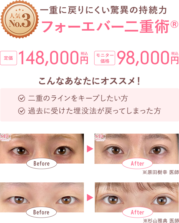 症例写真（No.333790）（No.328025）