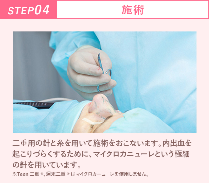 ステップ4