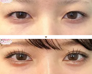 二重症例写真