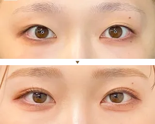 二重症例写真