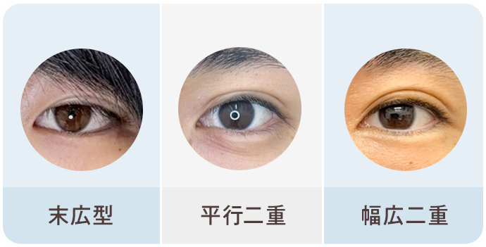 理想のデザインを実現できる