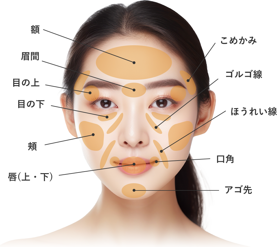 ナチュラル脂肪注射コンデンスリッチ(お顔の脂肪注入)の対象部位