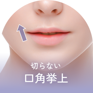 切らない口角挙上