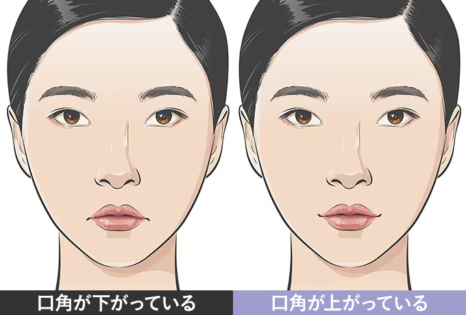 切らない口角挙上 イメージ2