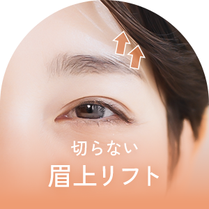 切らない眉上リフト