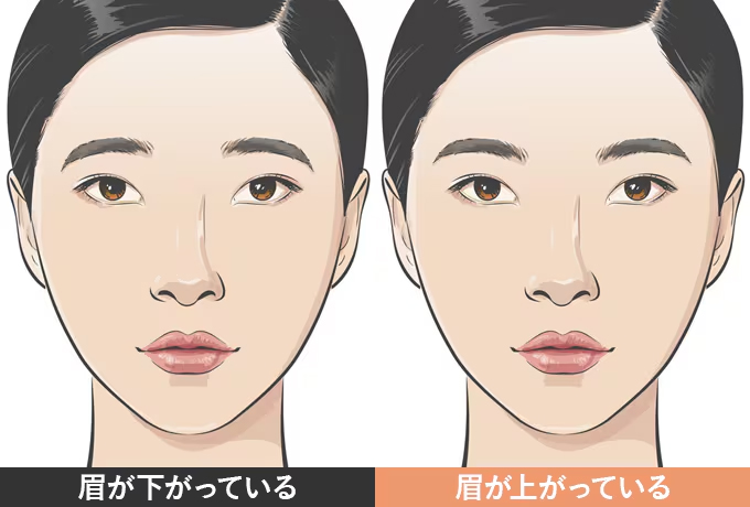 切らない眉上リフト イメージ2