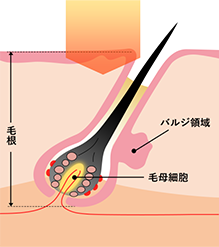 非医療機関の脱毛