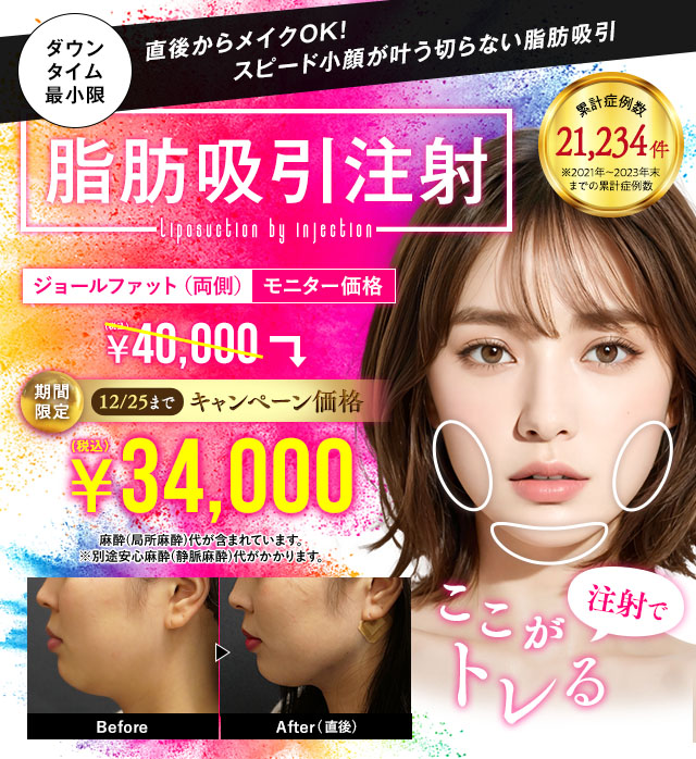 小顔用脂肪吸引注射