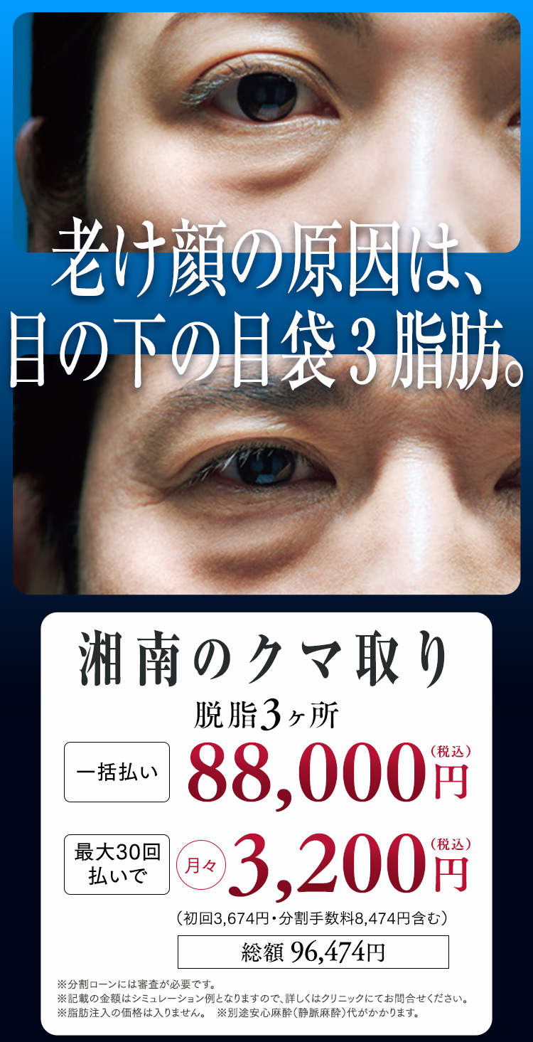 目の下の切らないクマ・たるみ（ふくらみ）取り