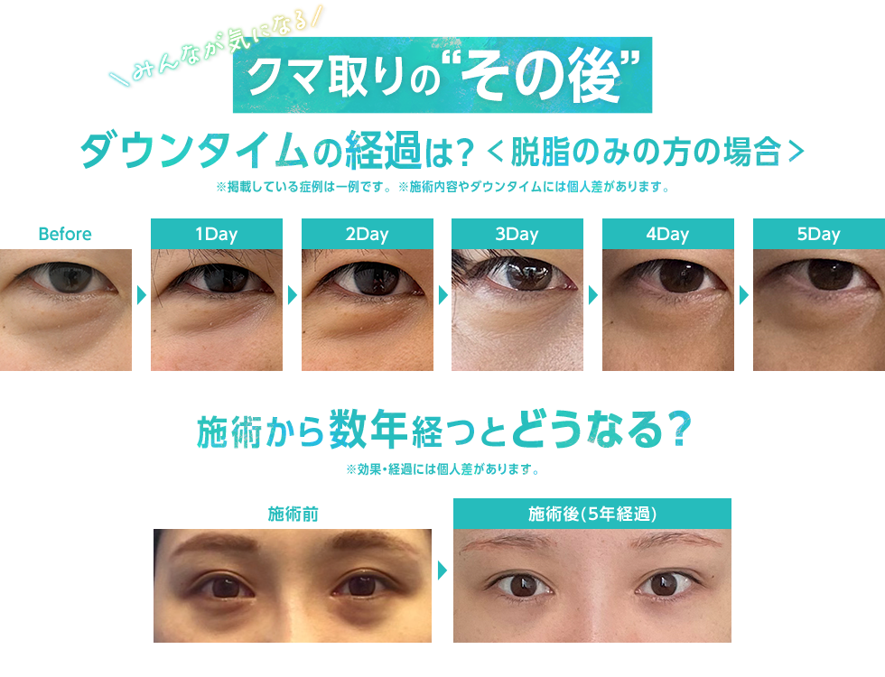 湘南のクマ取りで根本治療しませんか？