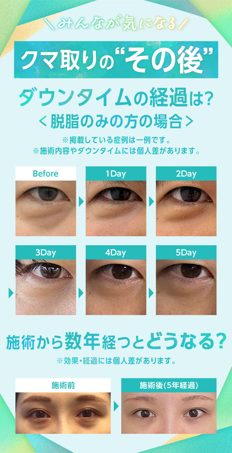 湘南のクマ取りで根本治療しませんか？