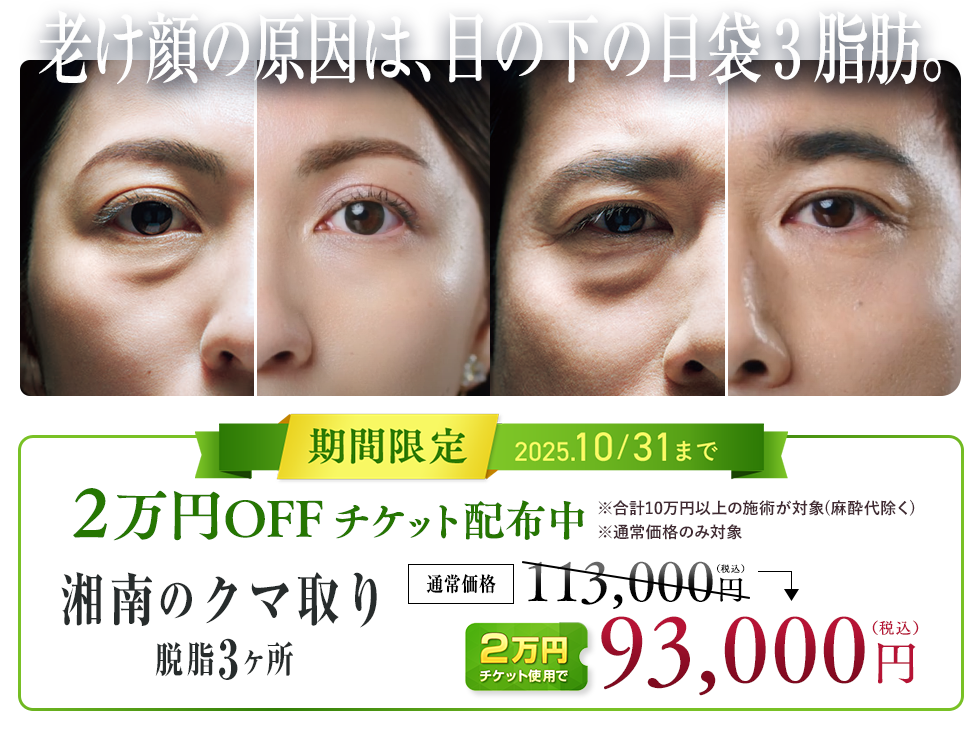 目の下の切らないクマ・たるみ(ふくらみ)取り