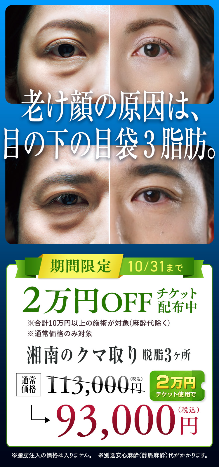 目の下の切らないクマ・たるみ(ふくらみ)取り