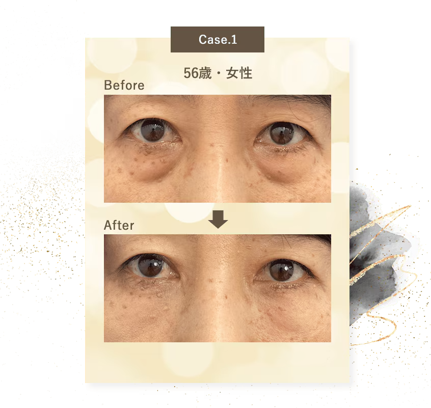 Case.1