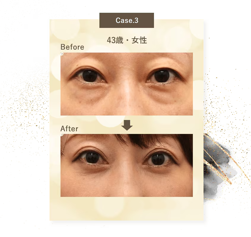 Case.3