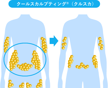 メディカルサイズダウン®