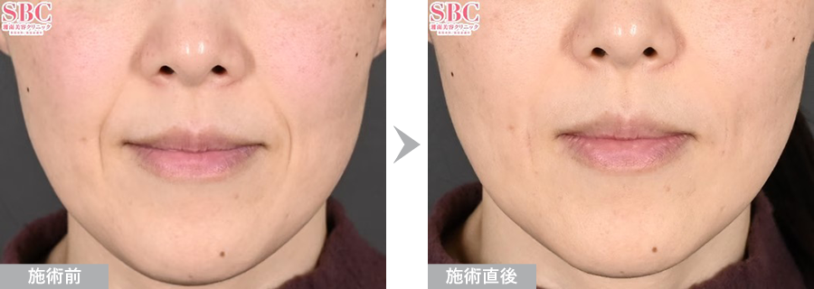 症例写真（No.324726）