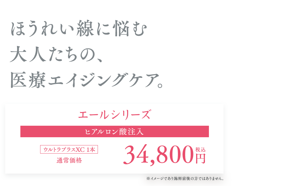 エールシリーズ